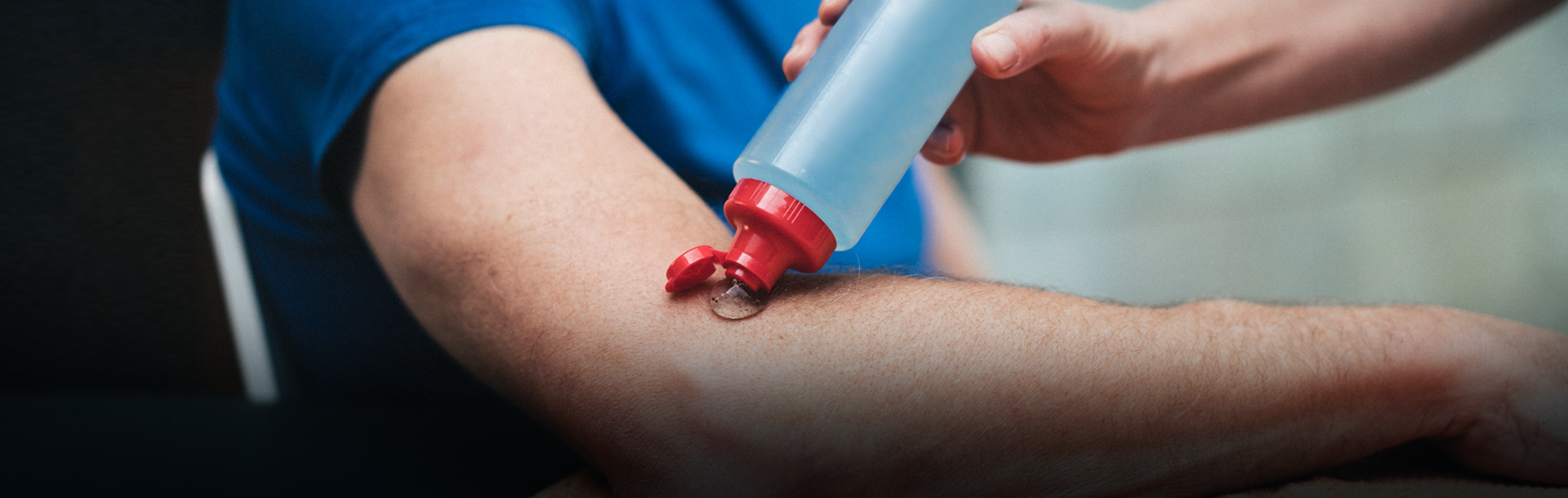 Application guidelines for radial pressure wave therapy